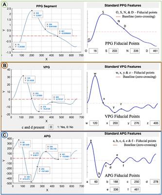 PPGFeat: a novel MATLAB toolbox for extracting PPG fiducial points